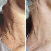 דר קסניה כהויות מתחת לעיינים