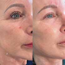 צוואר דר קסניה זרעי סלמון פתח תקוה