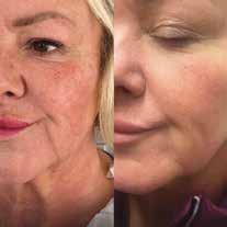 צוואר מרקם עור דר קסניה זרעי סלמון